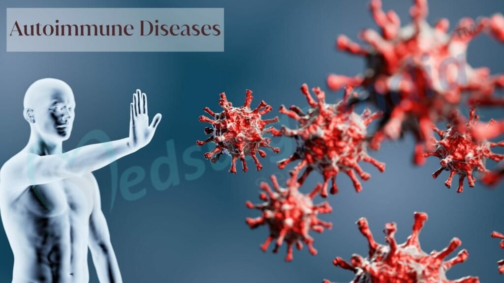 autoimmune disease 3172722152